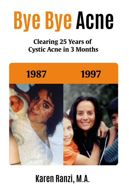 Bye Bye Acne: Clearing Over 25 Years of Cystic Acne in Three Months